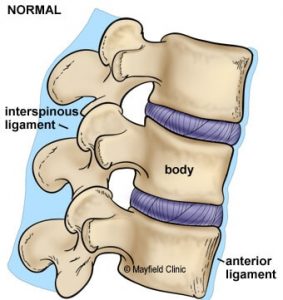 How to Sit With a Fractured Vertebrae CORRECTLY - Office Solution Pro